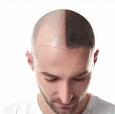 ͷֲ
