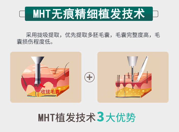 MHT޺۾ϸֲ