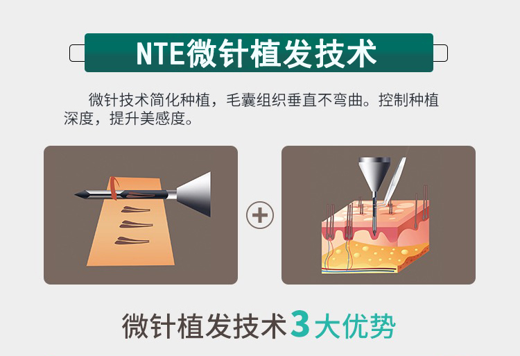 NTE΢ֲ